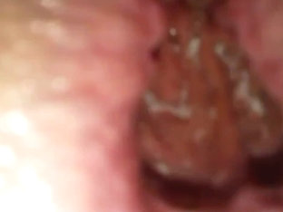 Anal gaping close up